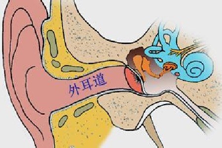 外耳真菌病:耳部发痒为主要症状,并有闷塞感,耳鸣及听力减退,外耳道