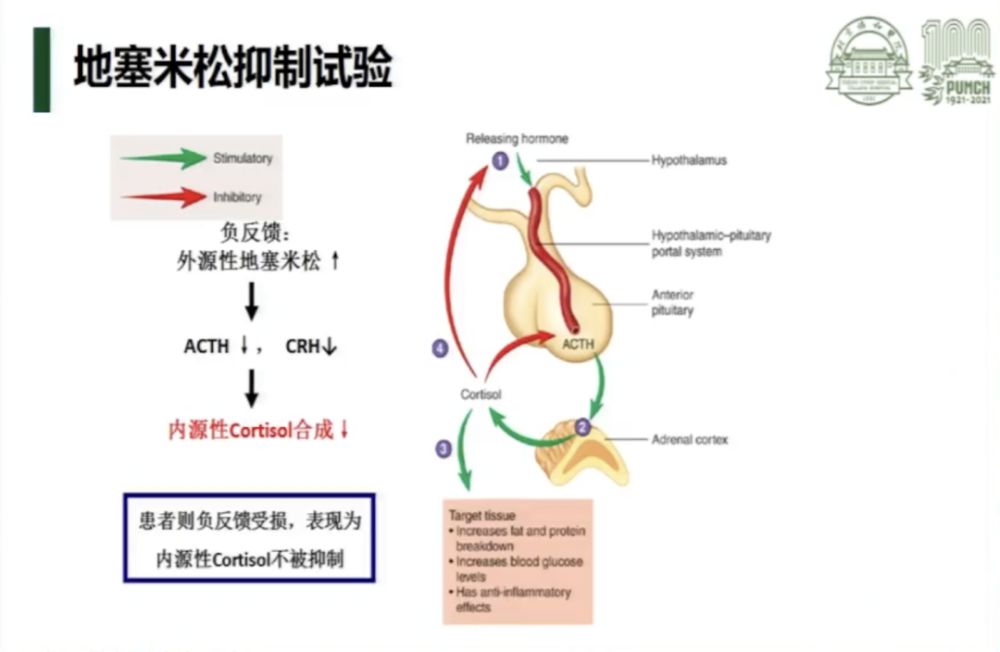 ppt分享陈适教授大剂量地塞米松抑制试验是否必要基于临床数据的新