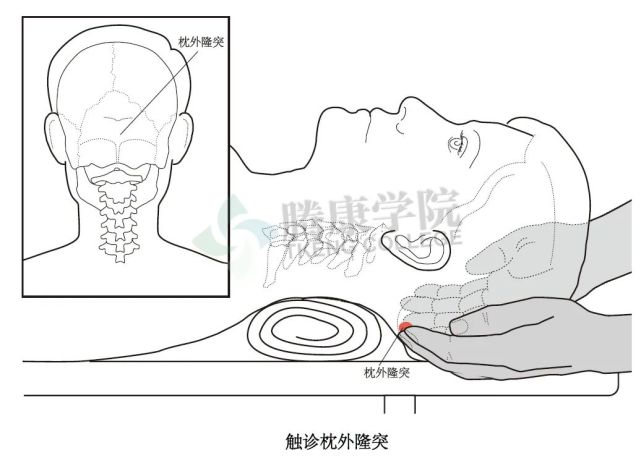 枕外隆突(枕外突起)骨性结构患者仰卧时,检查者坐在患者头部后面,这里