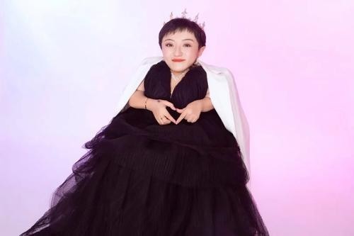 瓷娃娃李喜梅:80厘米嫁一米八老公,没钱后被抛弃,今又成公司总裁