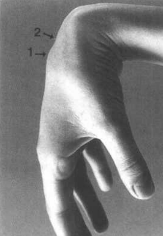 拇指指间关节置于豌豆骨上,沿远侧腕横纹稍偏远侧屈曲,示指放在手背