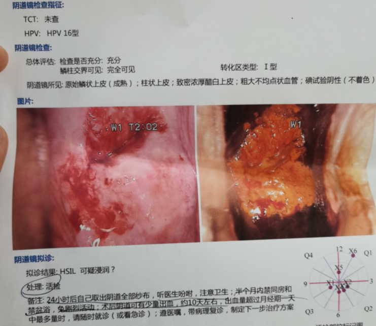 感染hpv之后3处地方会莫名瘙痒明眼人一看就知道