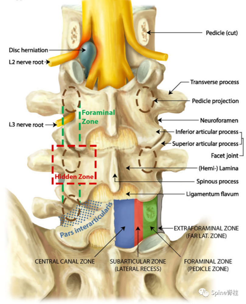 subarticular zone or lateral recess = 椎间关节下区(侧隐窝)fz