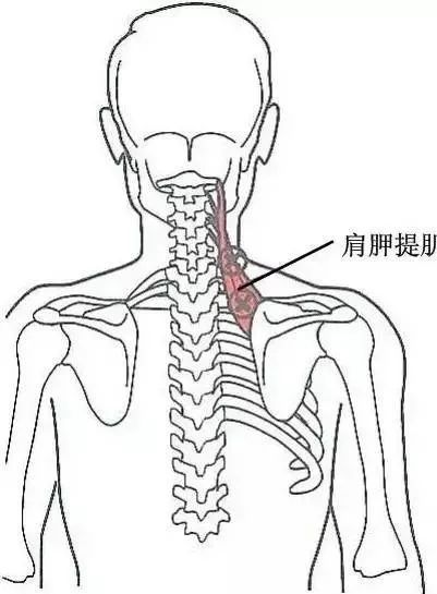 3,肩峰下压痛点此压痛点在肩峰下缘,亦称为肩峰下滑囊炎压痛点.