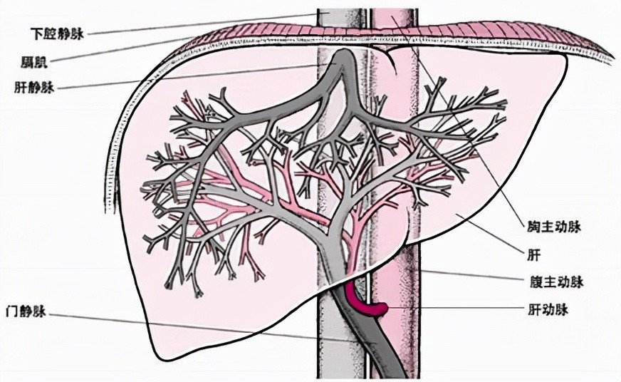 肝脏的血供非常特殊,下面是一张肝脏的血供图:一,门静脉高压肝硬化是