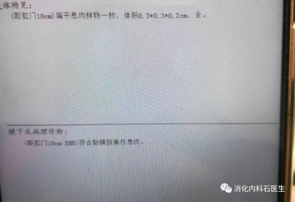 关于结肠息肉病理的问题识字就能看懂病理常识省的跑医院了全是干货