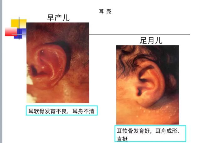 根据出生时胎龄可分为足月儿,早产儿和过期产儿.