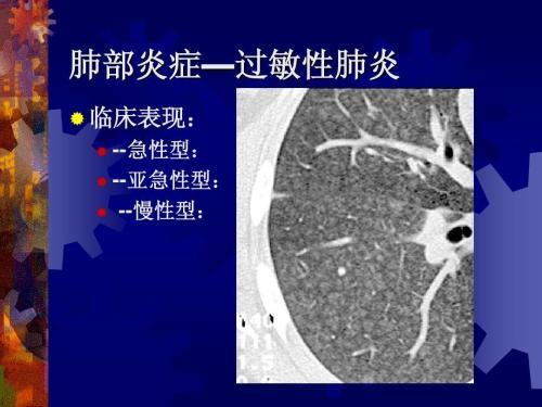 过敏性肺炎的ct分析