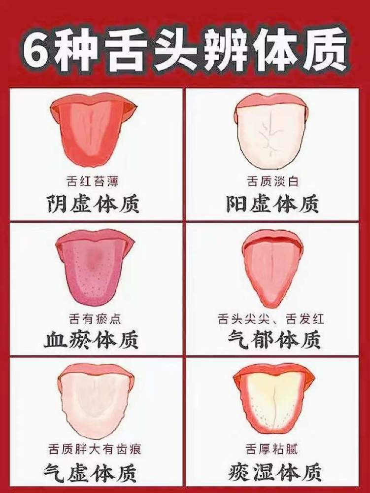 舌头的颜色及舌苔,是最能直观的反映我们身体健康度的.