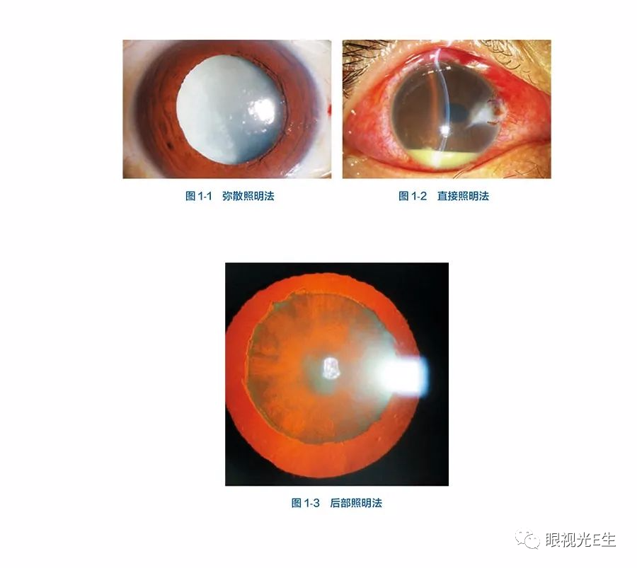 眼科裂隙灯显微镜操作手册