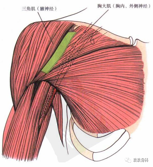 神经间平面位于三角肌与胸大肌之间,前者由腋神经支配,后者由胸内