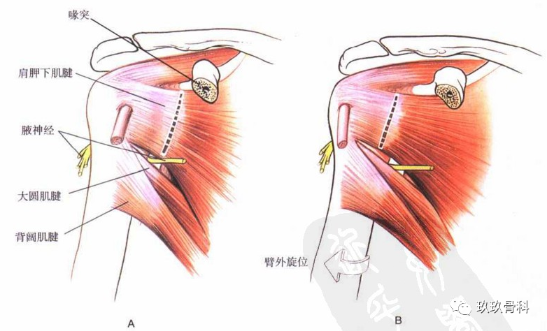 注意腋神经在肩胛下肌的下缘从前向后通过四边孔.