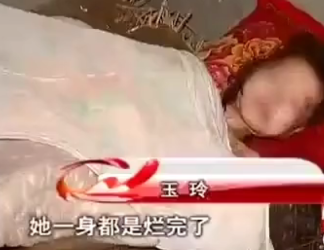 故事还要从达州市渠县一个村庄说起,蜷缩在床上的小女孩名叫玉玲,从