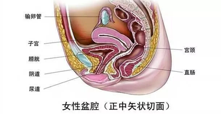 下腹疼痛需重视之盆腔炎