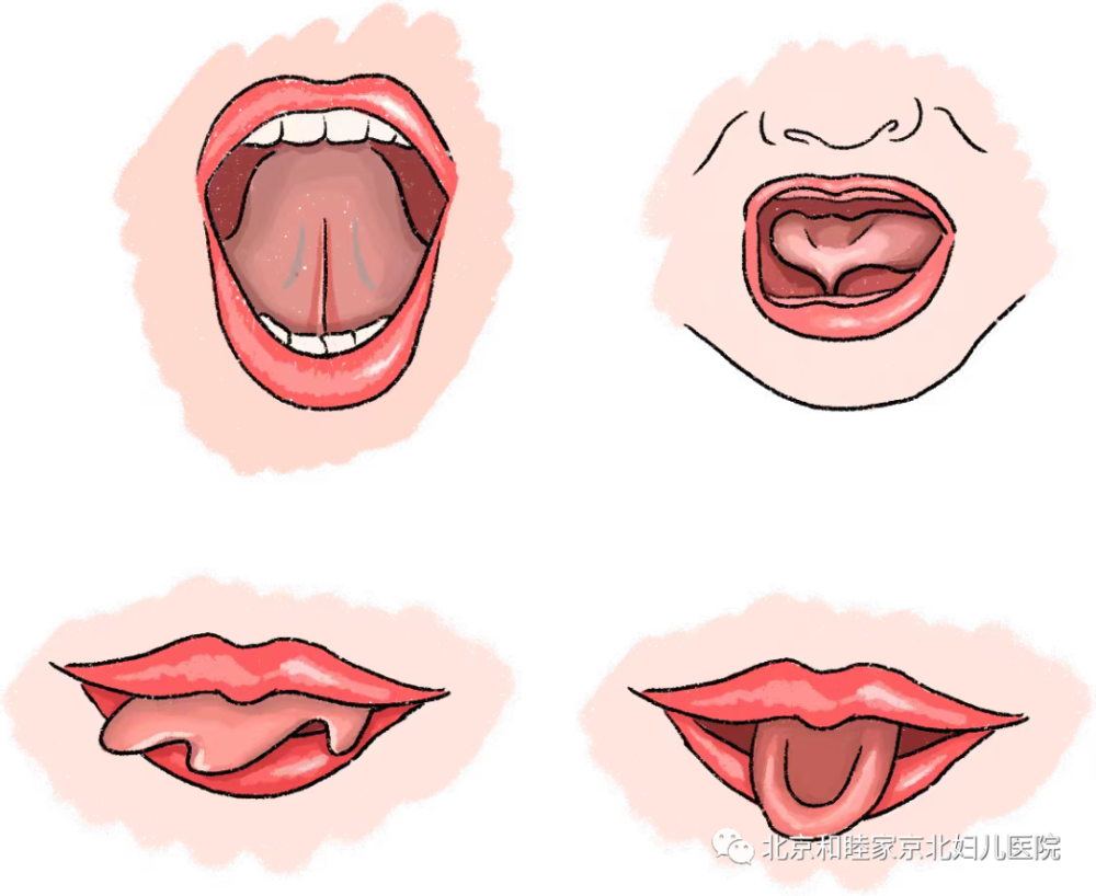 舌系带就是宝宝张开口翘起舌头时,在舌和口底之间的一条状组