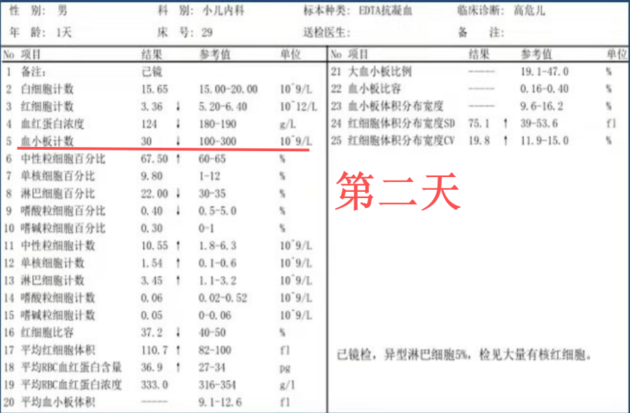 不明原因血小板严重减少凝血异常警惕这个病