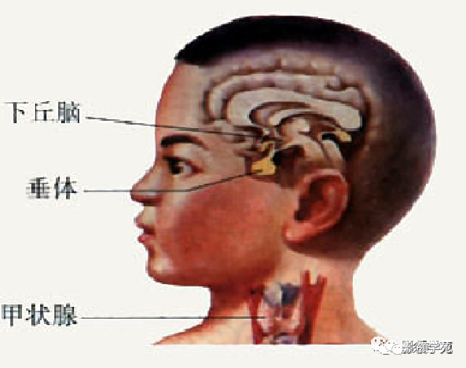 垂体解剖及常见病变影像学表现