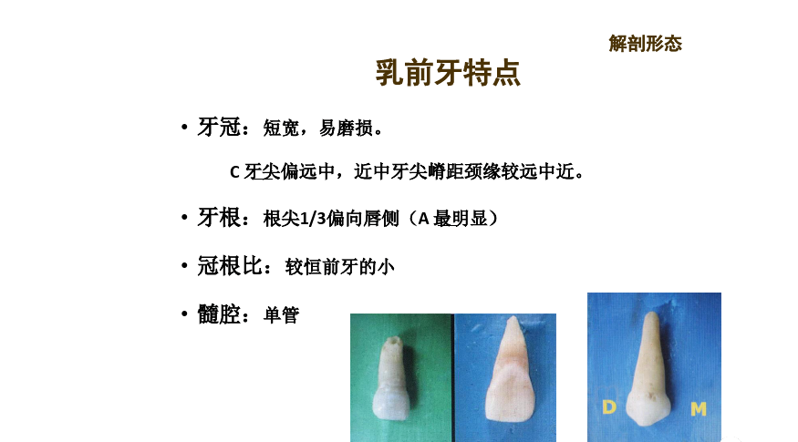 亚髓腔形态牙体形态乳牙解剖的形态乳牙解剖形态与组织结构特点乳牙预