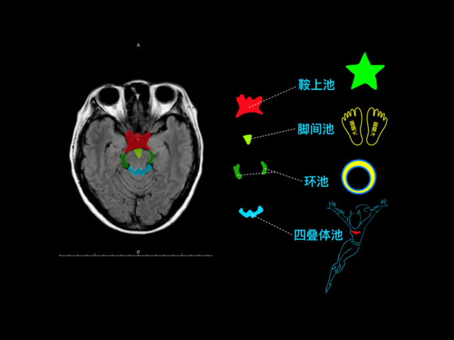 鞍上池,脚间池,环池,四叠体池感谢徐桂兴博士授权发表.
