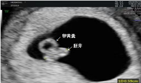 【揭秘】胎儿发育全过程,高能实拍图来袭!