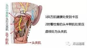 肌肉收缩而产生的神经压迫症状,即枕大神经在穿经斜方肌,半棘肌时均