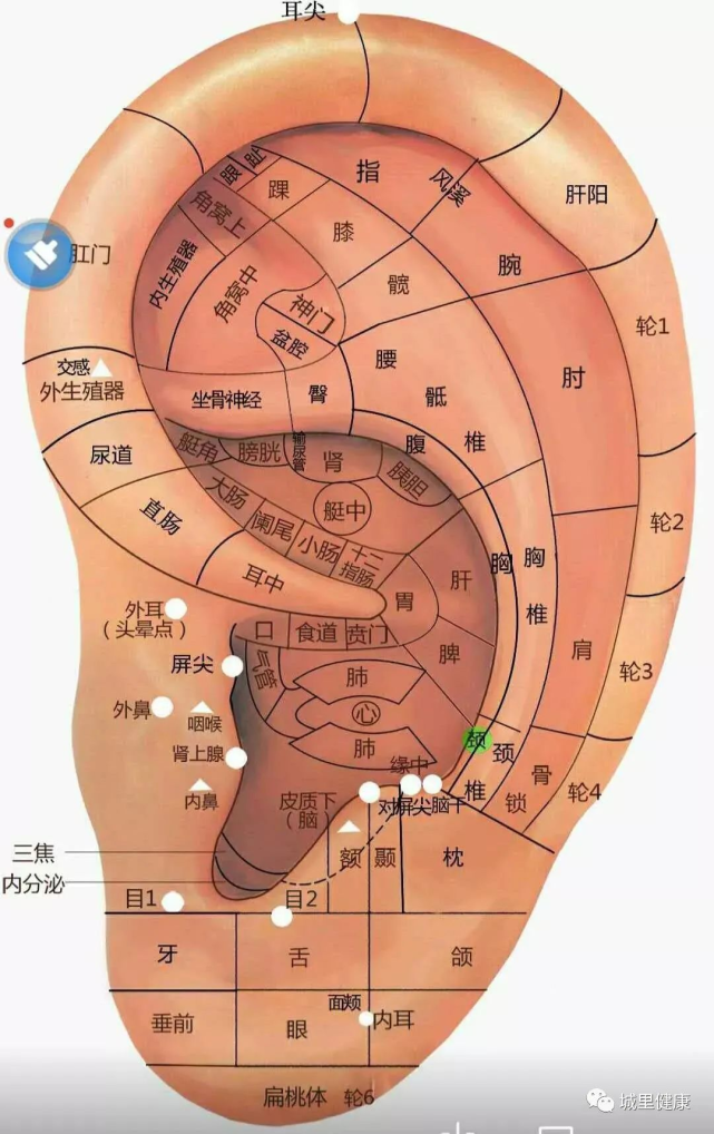 肝阳上亢证的高血压患者,用一次性采血针迅速点刺出3~5滴血,患者的