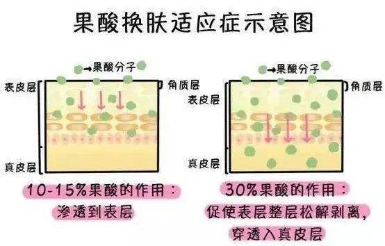 刷酸前必看重点这些要点你一定要了解清楚做果酸换肤的频率怎么把握