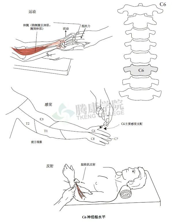运动水平伸腕肌(桡侧腕长伸肌,腕短伸肌)是由桡神经支配,代表c6神经根