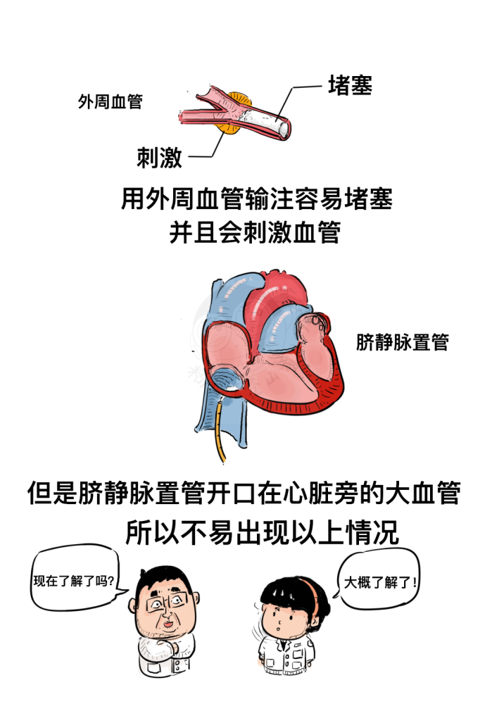 早产儿成长记脐静脉置管