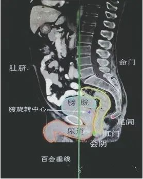 说命门再讲讲尾闾