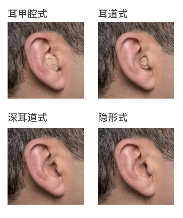 一文带你了解不同外形助听器优缺点