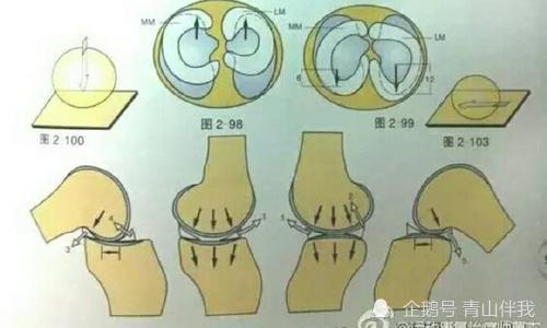 半月板损伤的症状是什么