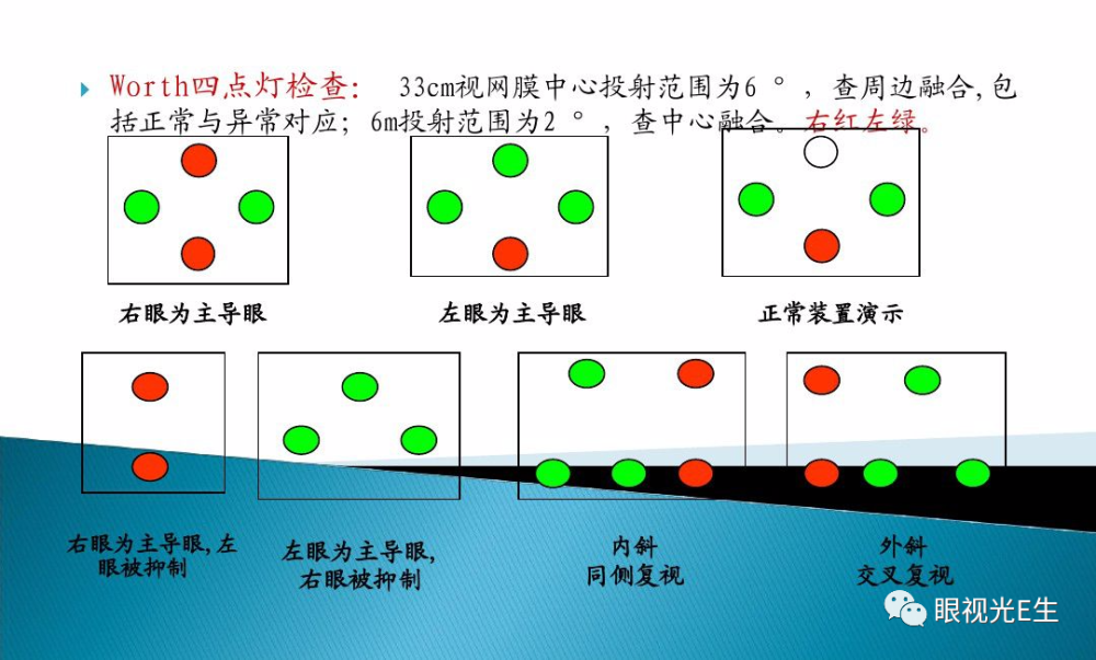 worth四点检查分析原理三级视功能是指两只眼睛具有的本质特性,两只