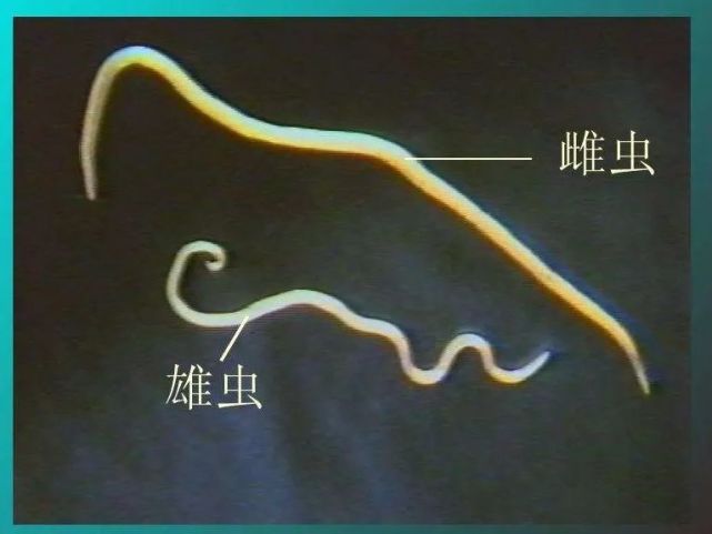 几十年前大人小孩都有蛔虫吃宝塔糖除虫为何成儿时回忆了