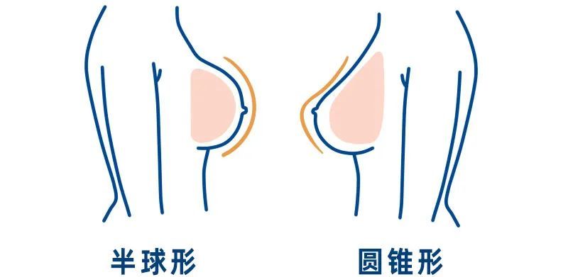 不仅每个女性的乳房会长得不一样,有分为圆盘型,圆锥型,纺锤型,半球型