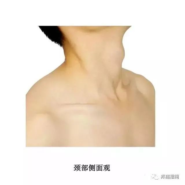 上项线:位于枕外隆凸的两旁,向乳突基部伸展弯曲的横行骨嵴,有胸锁