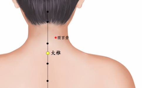 艾灸督脉通三关缓解后背酸痛