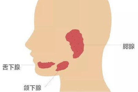 腮腺肿瘤术后日常护理要注意哪些