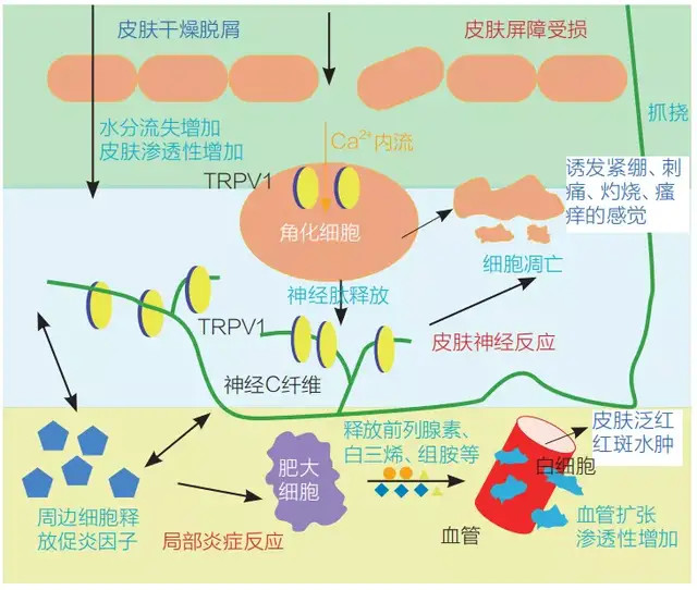 涉及的成因有皮肤屏障功能受损,表皮存在炎症状态,血管反应性增高