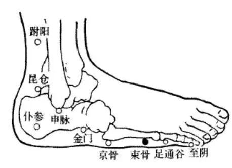 针灸调理肩周炎