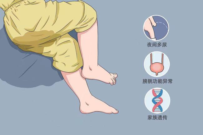 重庆天佑儿童医院十几岁了还在尿床多种原因可导致孩子患上遗尿症