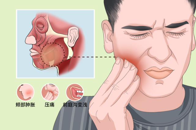 这是重症医学科在一个月内收治的第3例颌面间隙感染患者