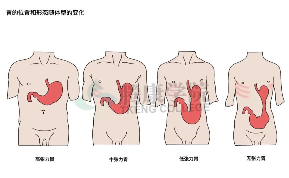 同时,不同体型的人群,胃的形态也不同.