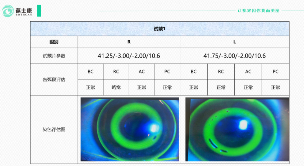 静态评估os:41.75-3.00/10.6 azt=2od:41.25-3.00/10.