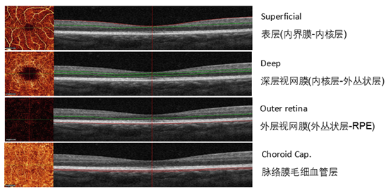 oct:视网膜脉络膜的层层分析