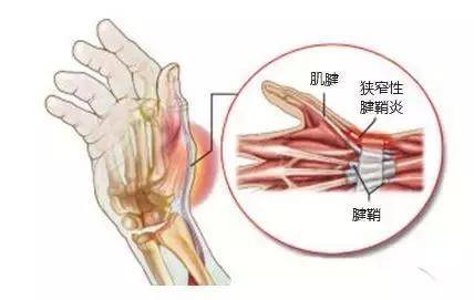 中药,针灸,手术,食疗,哪一种疗法适合你?