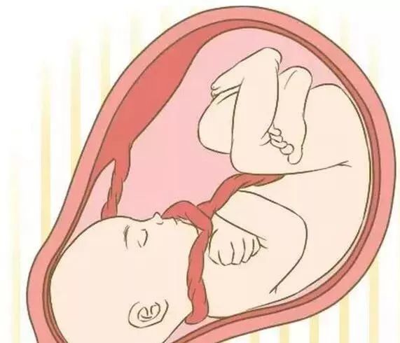 胎儿脐带绕颈和这几个习惯有关