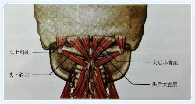 紧张性头痛的元凶枕下肌