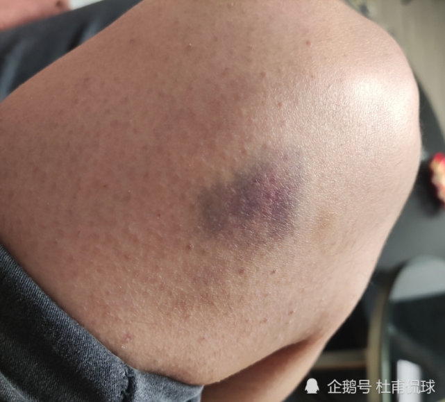 打女生到鼻青脸肿,逃跑后被6保安抓回