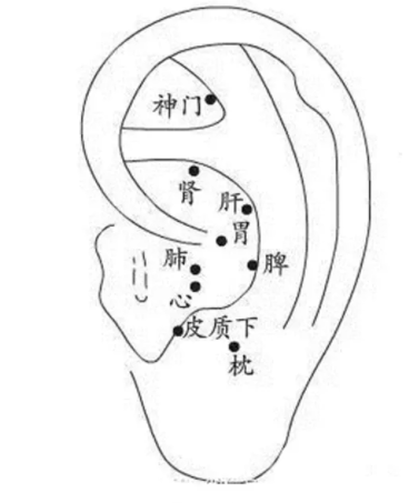 或热水洗脚,按摩涌泉穴,大陵穴,神门穴和安眠穴,改善睡眠.